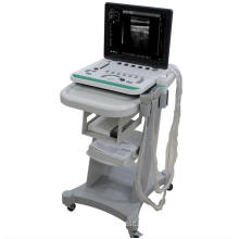 Laptop Ultrasound Scanner with trolley A